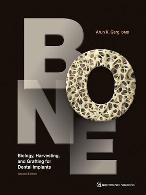 cover image of Bone